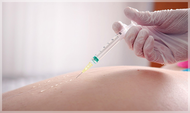 Mesotherapie