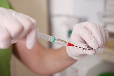 Mesotherapie
